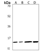 NDUFB4 Antibody抗体，orb1879771，b