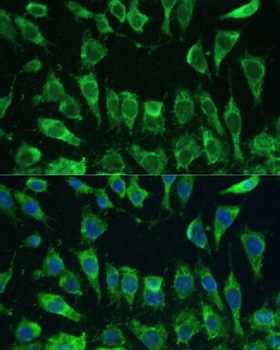 LGALS3 Antibody, KO Validated抗