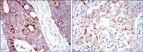 KRT19 Antibody抗体，orb69440，bior