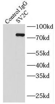 SV2C Antibody抗体,orb631658,bior