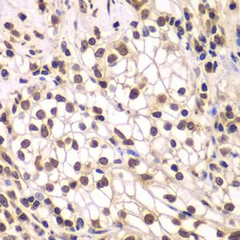 SMARCC1 Antibody抗体，orb631319，b