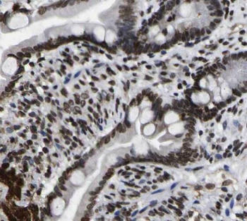 SNRPD3 Antibody抗体，orb631375，bi