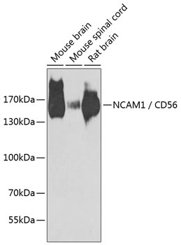 NCAM1 / CD56 Antibody抗体，orb125