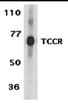 TCCR Antibody抗体，orb1238839，bio