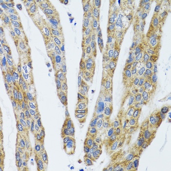 GAB1 Antibody抗体，orb1257137，bio