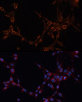 ALDH6A1 Antibody抗体，orb1257891，
