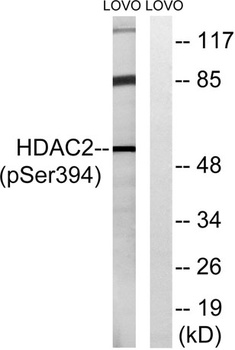 HDAC2 (phospho Ser394) rabbit 