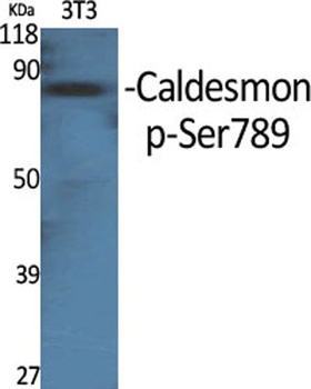 Caldesmon (phospho Ser789) rab