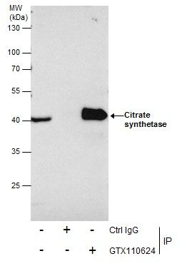 Citrate synthase antibody [N2C