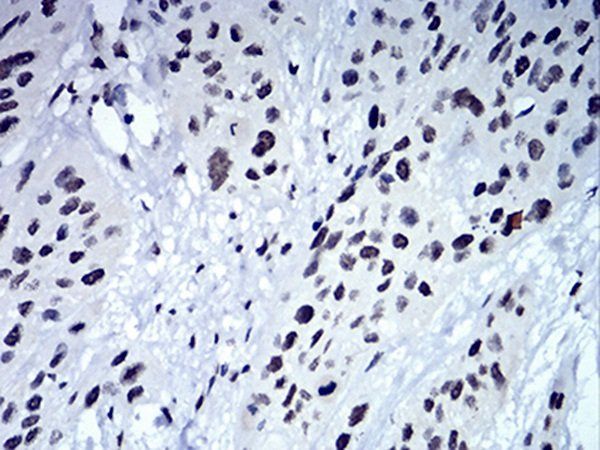 CBX5 Antibody抗体，orb333912，bior