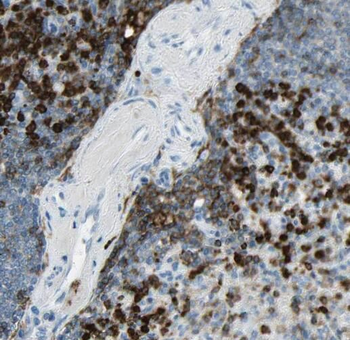 STAT6 Antibody抗体，orb631574，bio