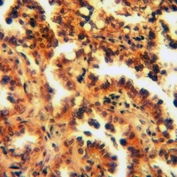 B3GALT4 Antibody抗体，orb214816，b