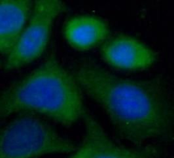 VPS18 Antibody抗体，orb632536，bio