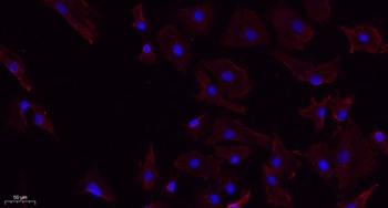 ChemR23 rabbit pAb抗体，orb764844