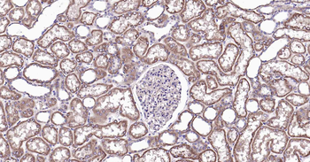 RalA Recombinant Rabbit Monocl