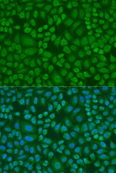 DROSHA Antibody抗体，orb1255901，b