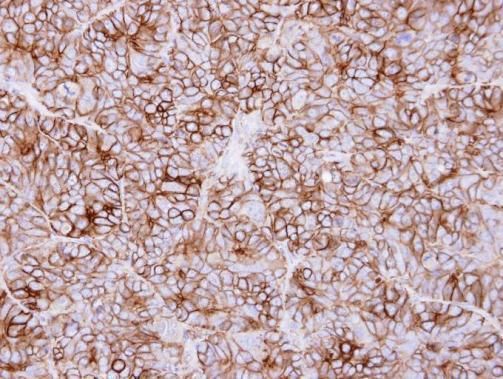 KIDINS220 antibody [C3], C-ter