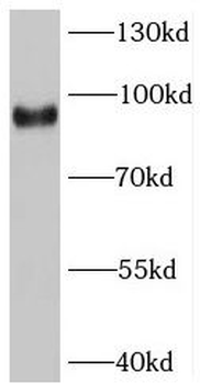 SV2C Antibody抗体,orb631658,bior