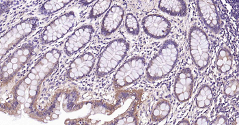 RalA Recombinant Rabbit Monocl