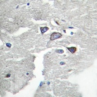 CDK5R1 p35 Antibody抗体,orb21484