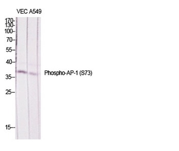 AP-1/Jun D (phospho Ser73/100)