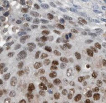 TTF1 Antibody抗体，orb632241，bior