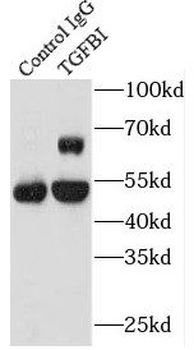 TGFBI Antibody抗体，orb631852，bio