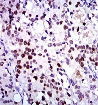 CDK2 Antibody抗体，orb97446，biorb