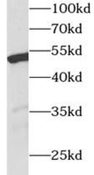 WT1 Antibody抗体，orb632626，biorb
