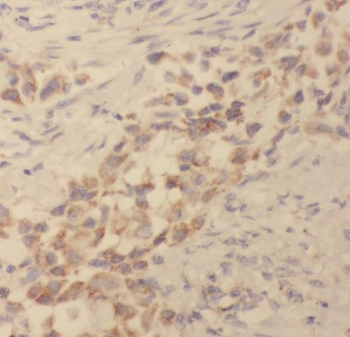 TPMT Antibody抗体，orb632075，bior