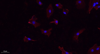 Calnexin rabbit pAb抗体，orb76470