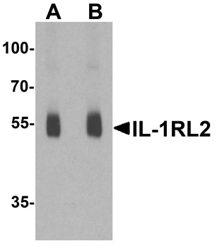 IL-1RL2 Antibody抗体，orb1239672，