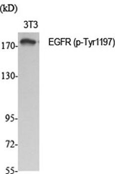 EGFR (phospho Tyr1197) rabbit 
