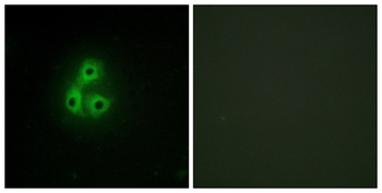 Csk rabbit pAb抗体，orb767730，bio