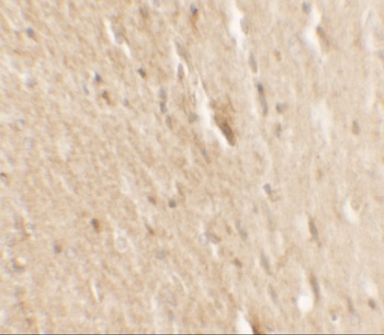 B-raf Antibody抗体，orb1239042，bi