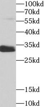 SULT1A1 Antibody抗体,orb631634,b
