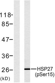 HSP27 (phospho Ser15) rabbit p