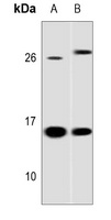 Galectin 1 Antibody [KO/KD Val