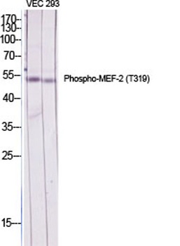 MEF-2 (phospho Thr319) rabbit 