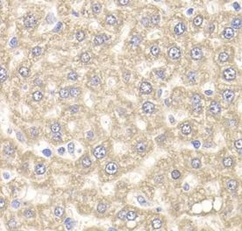 UBE2J2 Antibody抗体，orb632310，bi