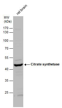 Citrate synthase antibody [N2C