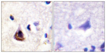 PI 3-kinase p85α rabbit pAb抗体，