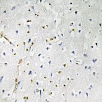 RhoBTB1 Antibody抗体，orb665757，b