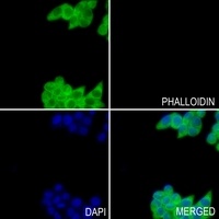 GSTM2 Antibody抗体，orb214022，bio