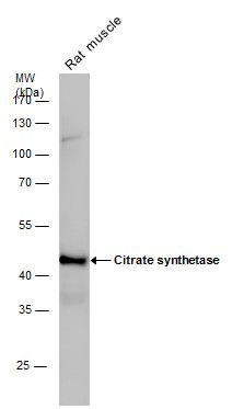 Citrate synthase antibody [N2C