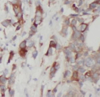 NAMPT Antibody抗体，orb632924，bio