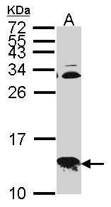 COX6B1 antibody [N2C3]抗体，orb55