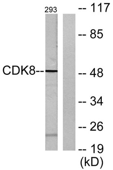 Cdk8 rabbit pAb抗体，orb764819，bi