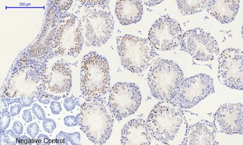 Histone H2A.X (phospho Ser139)