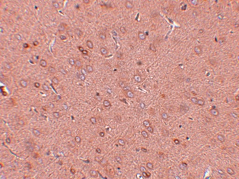 GOLPH2 Antibody抗体，orb1239740，b